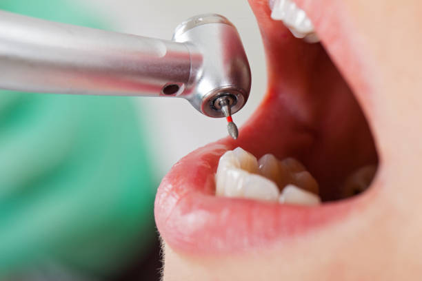 Best Walk-In Emergency Dentist in Ilchester, MD